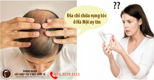 Địa chỉ chữa rụng tóc ở Hà Nội