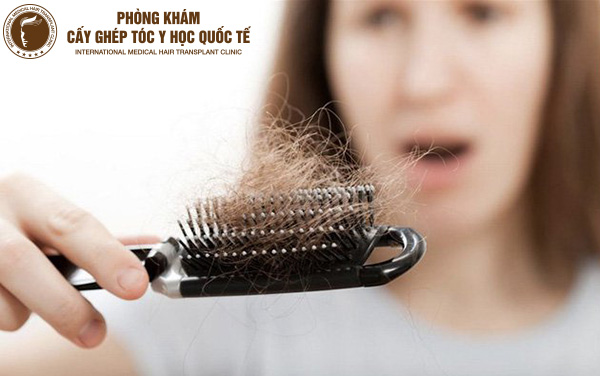 rụng tóc nhiều ở nữ là bệnh gì