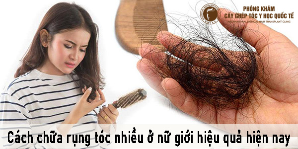 cách chữa rụng tóc nhiều ở nữ giới