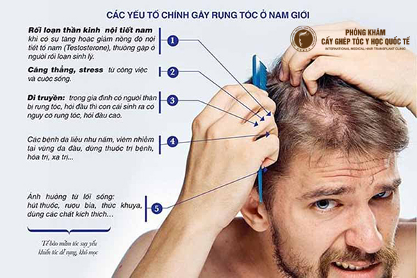 cách ngăn rụng tóc ở nam giới
