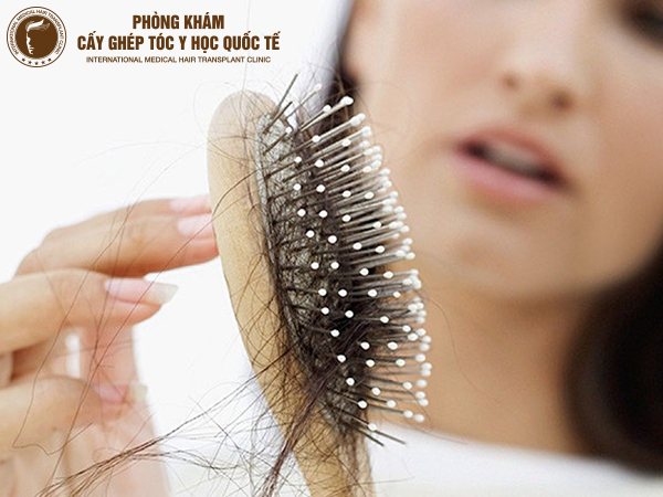 cách trị rụng tóc hiệu quả