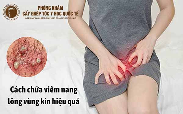 viêm nang lông vùng kín