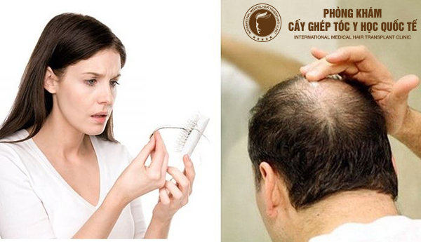 biện pháp ngăn ngừa rụng tóc