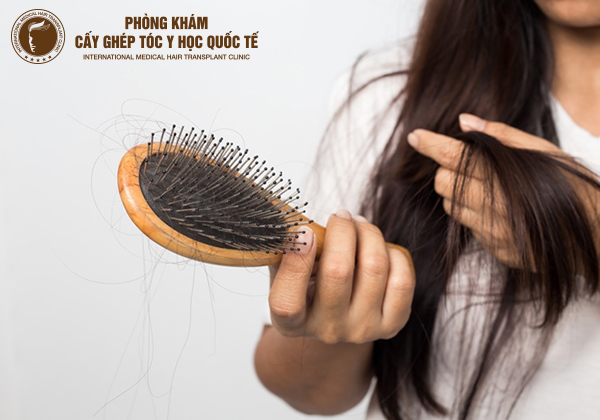 cách chữa rụng tóc và kích thích mọc tóc