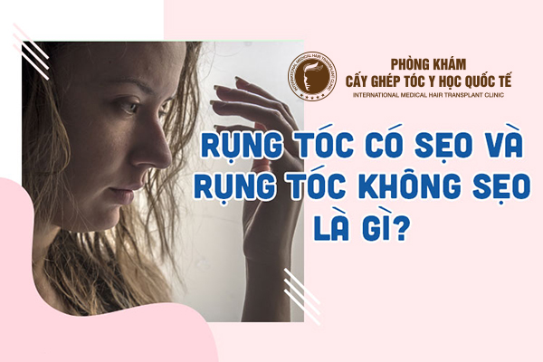 rụng tóc không sẹo là gì