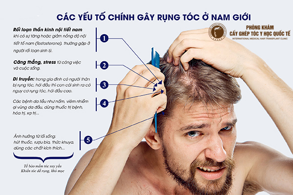 Cách chăm sóc tóc nam đơn giản nhất định ai cũng phải biết