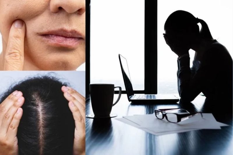 rụng tóc do stress tâm lí 