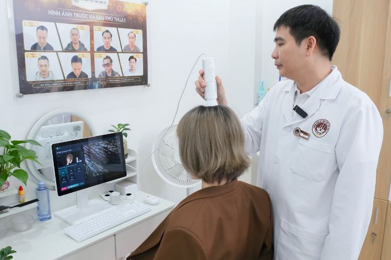 cách chẩn đoán hói đầu nữ giới