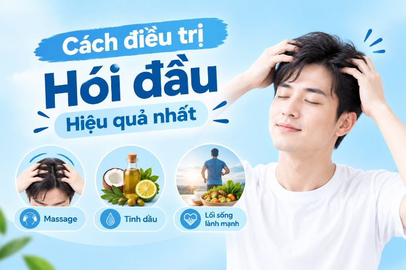 cách trị hói đầu hiệu quả 