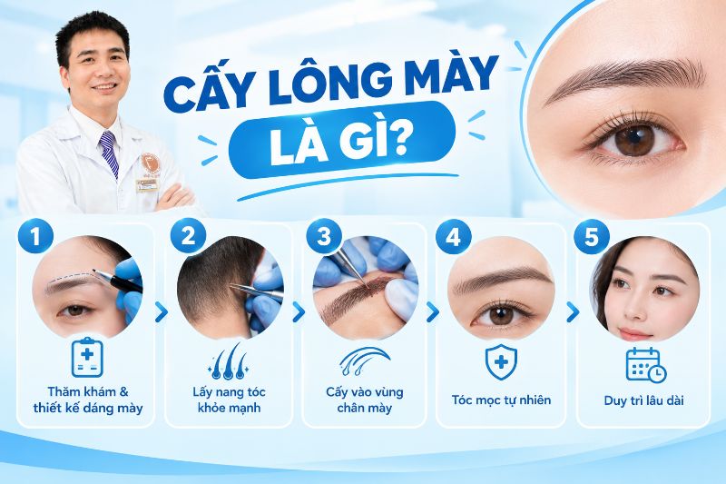 cấy lông mày là gì