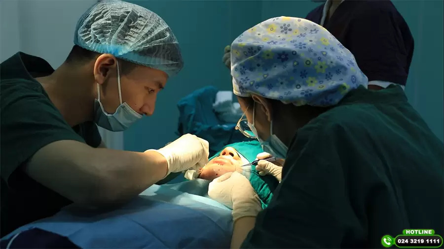 cấy râu thẩm mỹ 