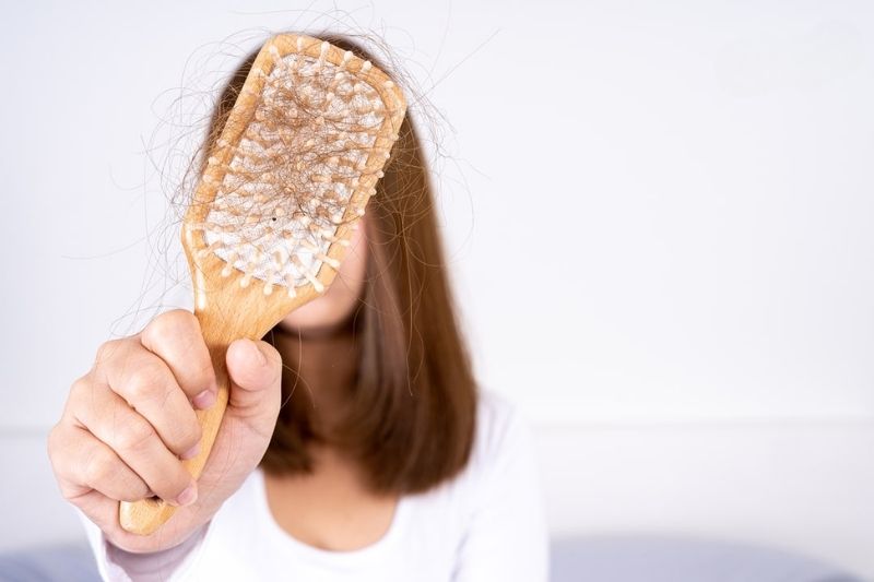 Dấu hiệu nhận biết hói đầu sớm ở người trẻ
