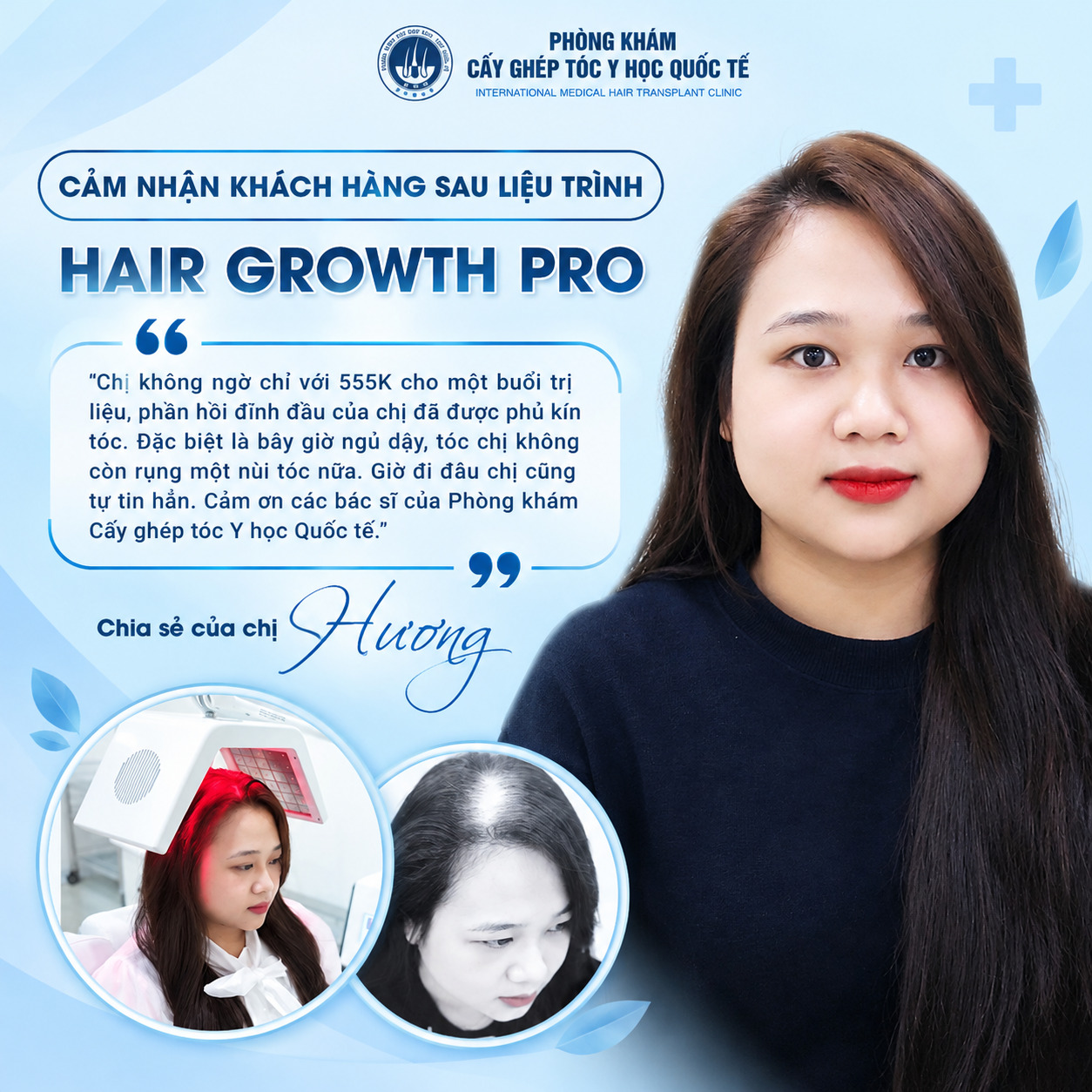 điều trị rụng tóc hair growth pro 