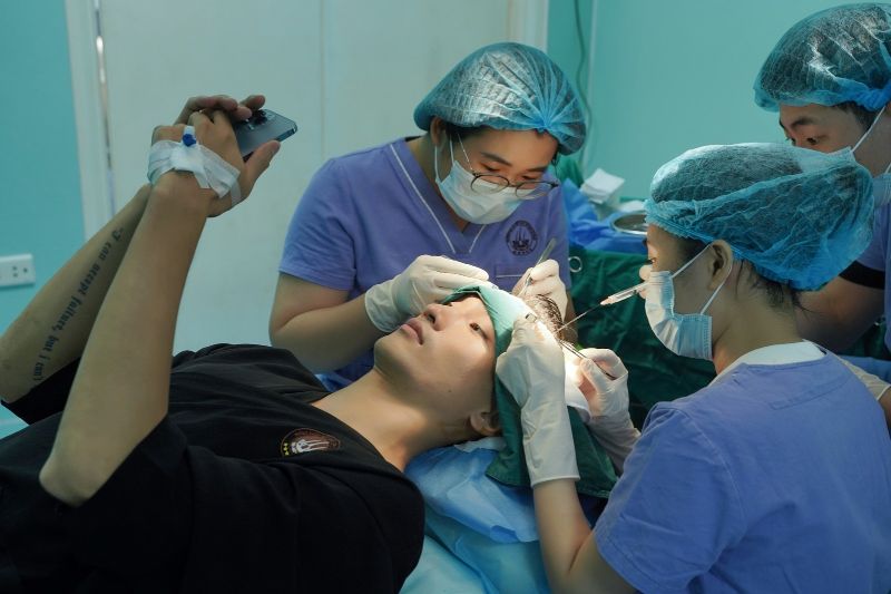 giai đoạn cấy ghép nang 