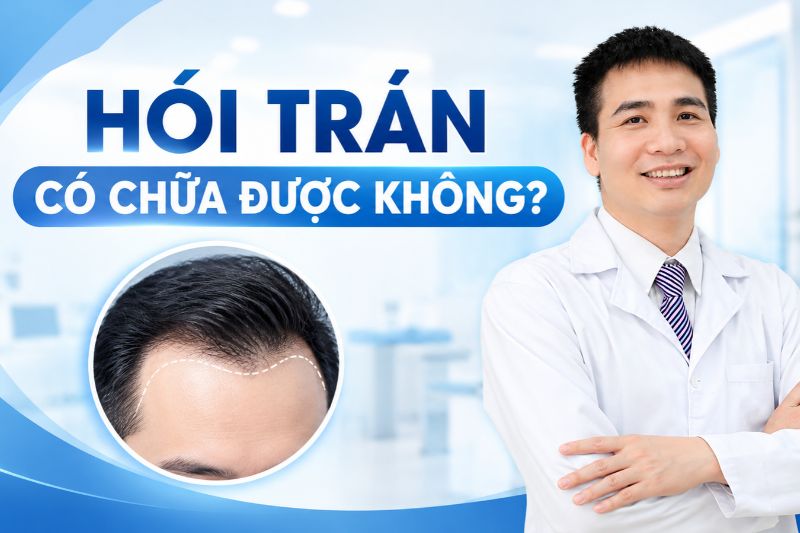 hói trán có chữa được không 
