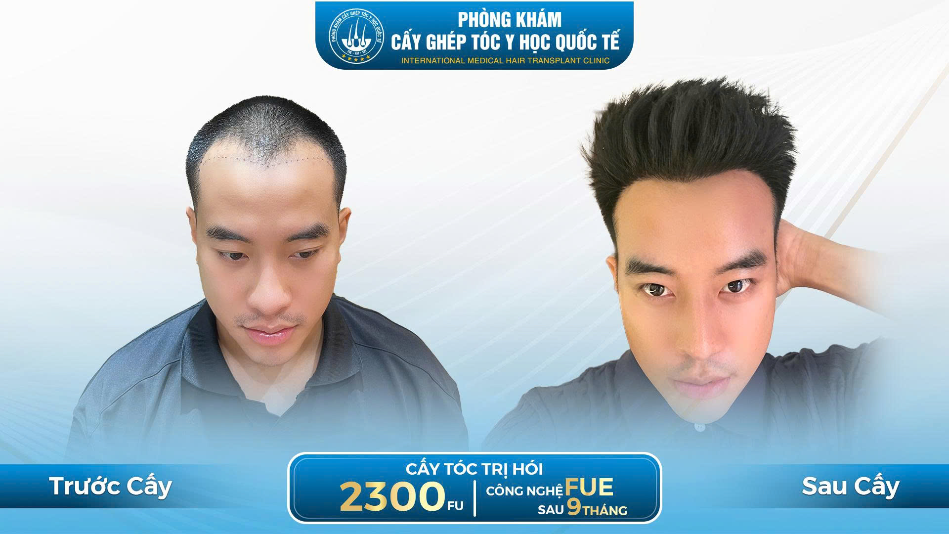 kết quả sau cấy