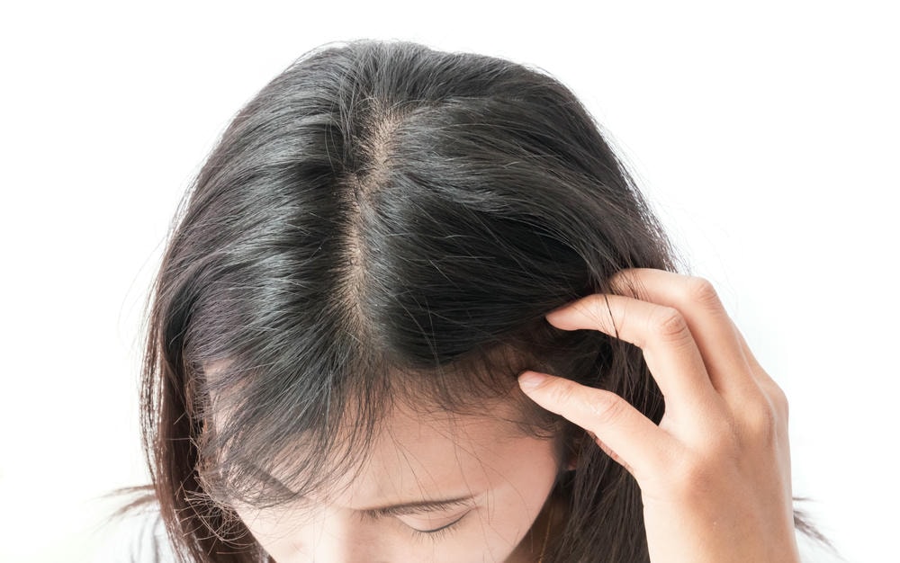 lạm dụng thuốc kích thích mọc tóc 