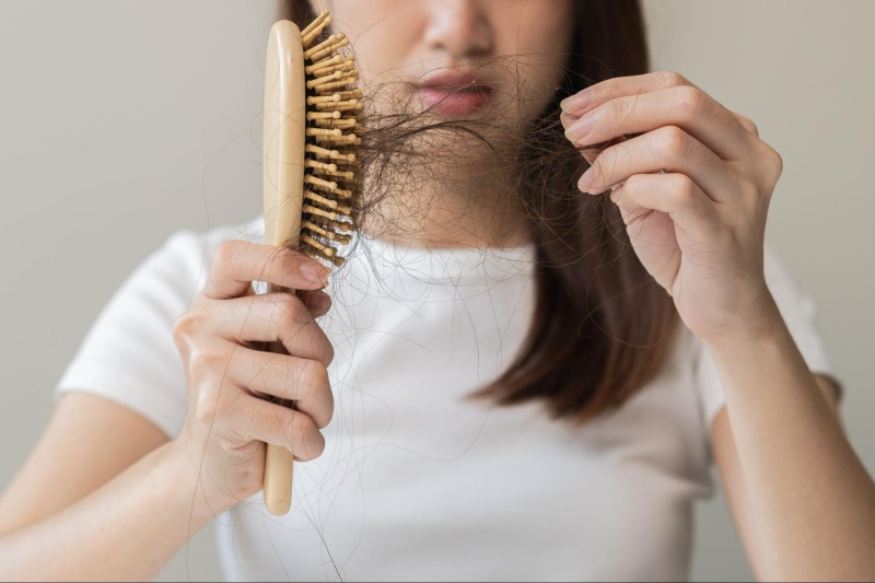 rụng tóc do rối loạn thần kinh nội tiết 
