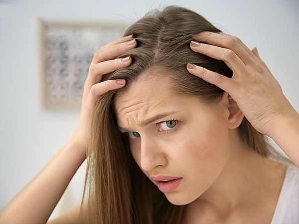 tóc thưa bẩm sinh