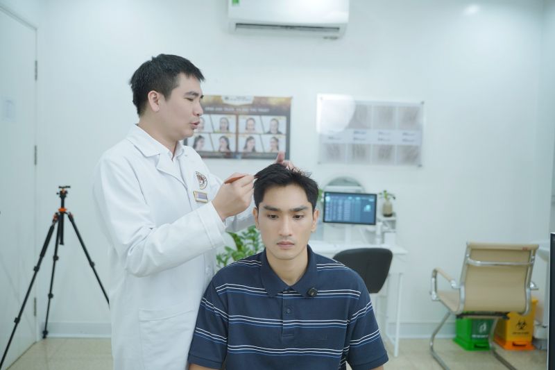 trước cấy tóc 